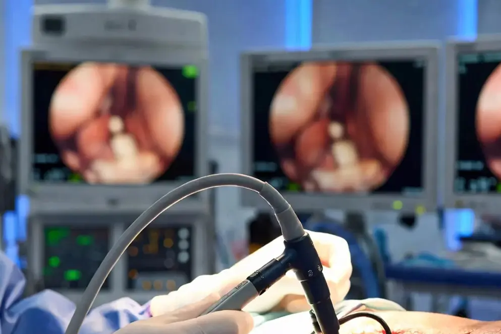 estenosis de canal lumbar cirugía endoscópica Lima